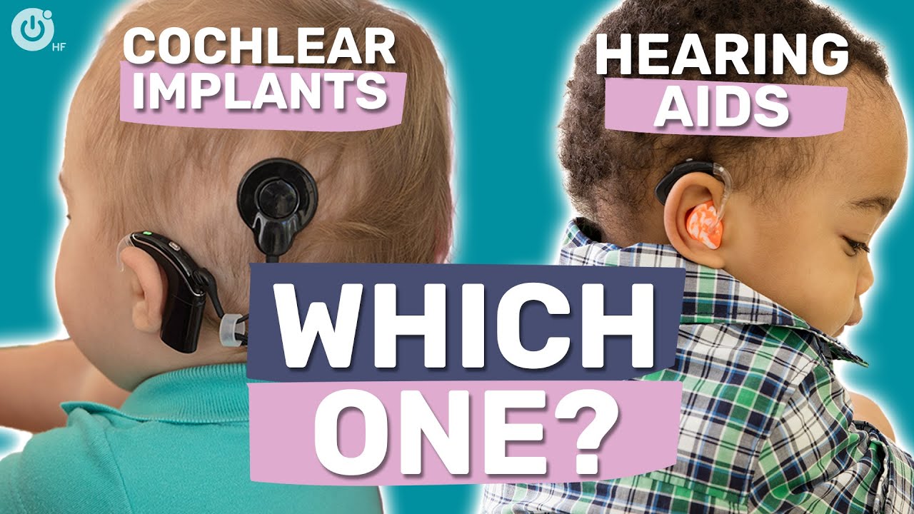 Hearing Aids Vs Cochlear Implants (For Babies And Kids) - YouTube