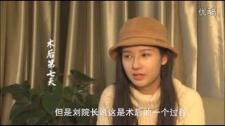 平面模特隆鼻后蜕变成为电影演员 - 网红新秀免费打造见红脸