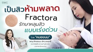 รักษาหลุมสิว ด้วยโปรแกรมใหม่ Fractora ที่คนเป็นสิวห้ามพลาด!!