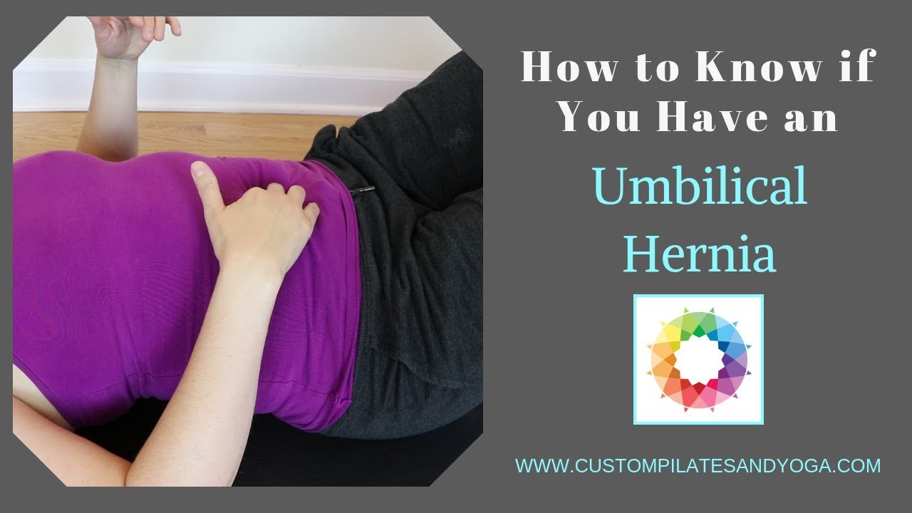 How To Know If You Have An Umbilical Hernia - YouTube