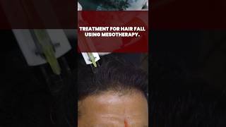 Treatment for hair fall using Mesotherapy | Hair treatment | HairMD Pune