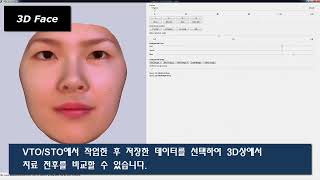 [OSSTEM CBCT] Cephalometric Analysis Software "V Ceph 8 0"