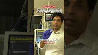 #icushort 374: How to pick circuit leak from volume-time graph on ventilator #esbicm