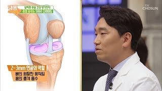 ‘비만’이 관절 건강에 미치는 영향은? [내 몸 사용설명서] 257회 20190621