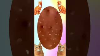 Blackheads Removal | Acne Treatment and Very Satisfying Satisfying Pimple pop #blackheads