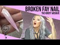 Extreme Stiletto on Fay's Broken Nail - Kirsty Meakin Archive #1