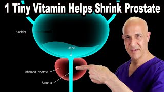 1 Tiny Vitamin Helps Shrink Your Enlarged Prostate | Dr. Mandell