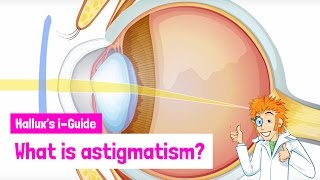 What is astigmatism?