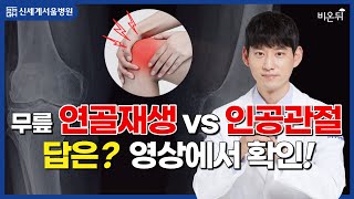 무릎 연골재생 vs 인공관절, 답을 드립니다