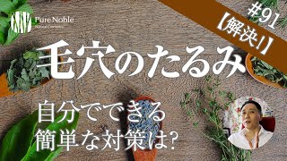 【頬の毛穴のたるみの原因は？】自分でできる対策や簡単ケア法〔#91〕