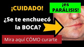 ¡CUIDADO! ¿SE TE FUE LA BOCA DE LADO? ¡Es parálisis! Mira aquí cómo curarte