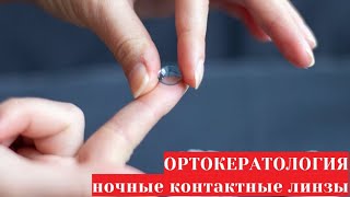 Ортокератология - ночные контактные линзы. Что это, сравнение с очками и лазерной коррекцией