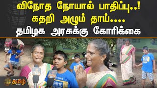 விநோத நோயால் பாதிப்பு.! கதறி அழும் தாய்.! தமிழக அரசுக்கு கோரிக்கை | Sivagangai