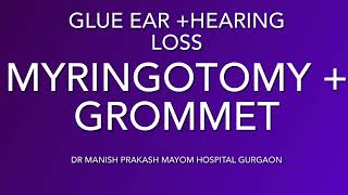 Glue Ear Treatment- Endoscopic Myringotomy Grommet Insertion- Dr Manish Prakash Mayom Hospital