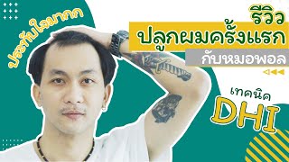 ใครอยากปลูกผมต้องดู รีวิวการปลูกผมถาวรกับหมอพอล All About Clinic