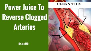 Green Vegetable Juice to Unclog Your Arteries