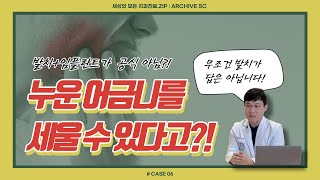 [EP. 06] 세대를 거듭할수록 치아교정 인구가 늘어나는 이유?!(feat. 치아직립 바로알기)