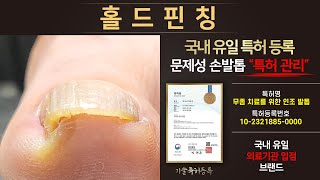 [특허관리] 말려 들어간 발톱 펼치기 / Using patented technology, spread out toenails.