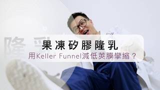 果凍矽膠隆乳用Keller Funnel減低莢膜攣縮？