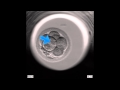 EmbryoScope Embryo Development - Large fragment looks like blastomere