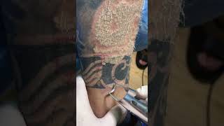 SCAR FREE TATTOO REMOVAL ep5 #short
