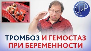 Гемостаз и тромбоз при беременности. ВЯЗКОСТЬ и СВЁРТЫВАЕМОСТЬ крови. Рассказывает Гузов И.И.