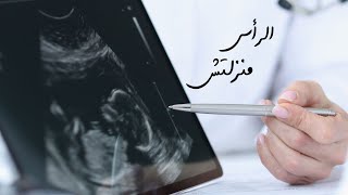 الرأس منزلتش