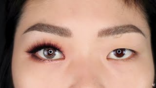 شاهد عملية توسيع العين|من اغرب عمليات التجميل_Eyelid widening surgery