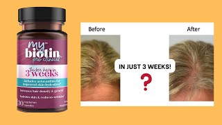 My Biotin Pro Clinical: Don't Buy Until You Know This