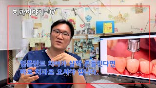 [치과이야기-37] 임플란트 치아가 흔들린다면 바로 치과에 오셔야 합니다.