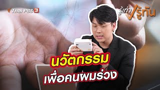 นวัตกรรมเพื่อคนผมร่วง | รู้เท่ารู้ทัน