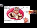 valves of the heart