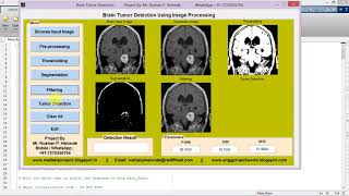 Brain Tumor Detection Using Image Processing Matlab Project Code