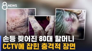 노인보호센터서 보호는 커녕 80대 할머니 '집단 폭행' / SBS