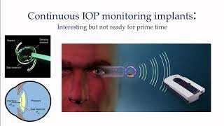 Lecture: Towards Constant Measurement of IOP: Dr. Malik Y. Kahook