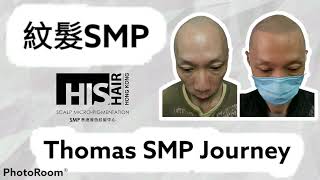 Thomas 紋髮 SMP treatment by Jonathan Tang