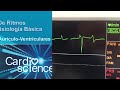 bloqueo auriculoventricular completo caso clínico