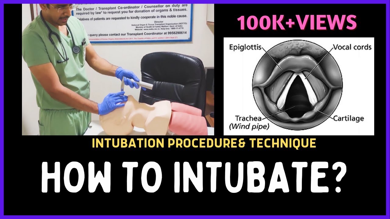 HOW TO INTUBATE? INTUBATION PROCEDURE & TECHNIQUE - YouTube