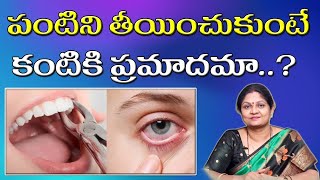 పంటిని తీయించుకుంటే కంటికి ప్రమాదమా..?|| Can teeth removing cause eye problems? ||