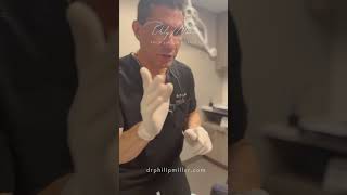 The Latest Technique in Deep Plane Facelift: Hemostatic Net! Let Me Explain