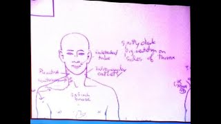 MICHAEL JACKSON: Pt 84 "The autopsy photo" (WARNING graphic!) (What DID happen on June 25th?)