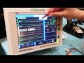 Demonstration: DigiCare LifeWindow Lite MultiParameter Monitor LW8