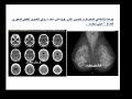 تأثير الأشعة التشخيصية على الجسم والحامل د. عبد الله حتاحت