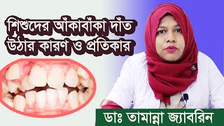 শিশুদের আঁকাবাঁকা দাঁত উঠার কারণ ও প্রতিকার। ডাঃ তামান্না জ্যাবরিন Our Health TV