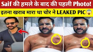 Saif Ali khan Attack After First Photo Leaked 😱 Saif Ali khan Lilavati Hospital Photo Viral