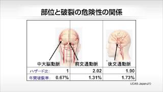 【U-info】未破裂脳動脈瘤はどれくらい破裂するのか