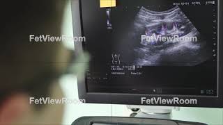 A male doctor looks at the ultrasound screen in a modern clinic.