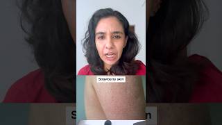 ഇതുപോലെ Strawberry skin എങ്ങനെ മാറ്റാം? #skincare #lekshmikrishnan