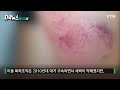 자막뉴스 젊은이들 단체로 우르르 ...한밤중 인천 골목 아수라장 ytn