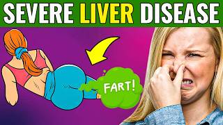 17 SIGNS that your LIVER is DYING | DANGEROUS! | 33